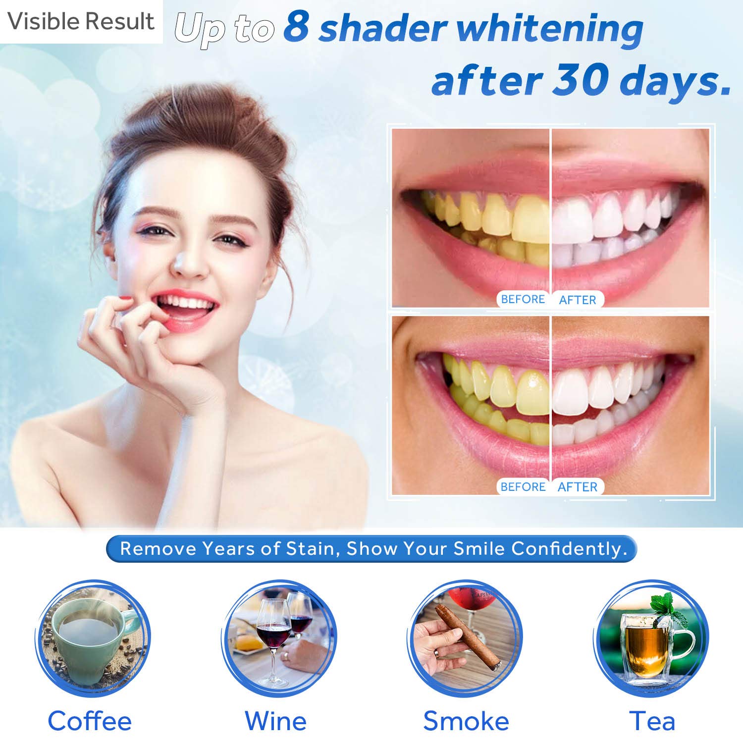 Teeth Whitening Gel Refill Syr - Teeth Whitening Paste 评论和价格