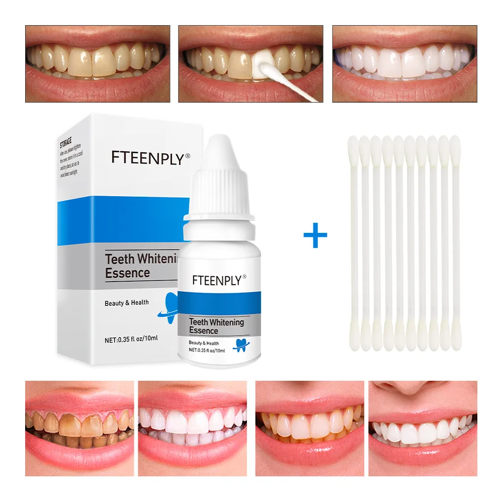 FTEENPLY Teeth Whitening Essen - Teeth Whitening Street 评论和价格