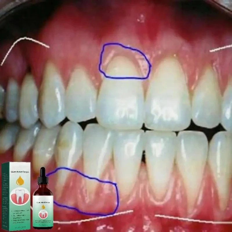 Gum Repair Drops Relieve Reced - Teeth Whitening Paste 评论和价格