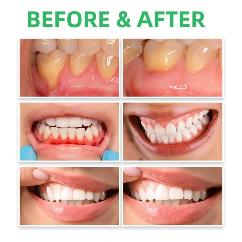 Gum Repair Drops Relieve Reced - Teeth Whitening Paste 评论和价格